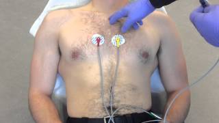 12 Lead ECG Placement example [upl. by Neik]