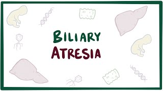 Biliary atresia  causes symptoms diagnosis treatment amp pathology [upl. by Eelnayr]