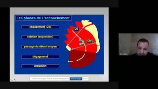 Mécanisme de l’accouchement quot accouchement normal à terme quot  gynécologie [upl. by Tatianna]