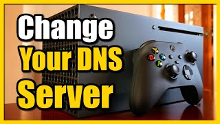 How to Change DNS Server on Xbox Series X Fast Tutorial [upl. by Adnarram]