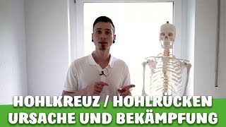 HOHLKREUZ HOHLRÜCKEN  Die WAHRHEIT zur Entstehung und Bekämpfung [upl. by Howie]