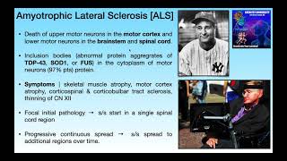 Amyotrophic Lateral Sclerosis ALS  Basics amp Clinical Presentation [upl. by Margot]