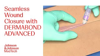 How To Apply DERMABOND ADVANCED Topical Skin Adhesive Effectively  JampJ MedTech [upl. by Sanger]