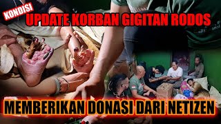 UPDATE SI BAIM KORBAN GIGITAN RODOSRANJAU DARATGIBUG  MEMBERIKAN DONASI DARI NETIZEN [upl. by Yerahcaz]