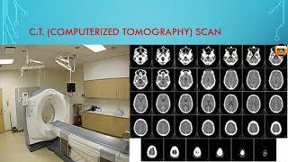 CT  computerized tomography Scan  in hindi [upl. by Ellicott]