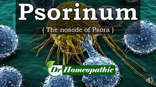 Psorinum  Homeopathic Medicine [upl. by Dominique]