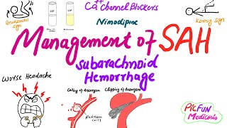 Management of Subarachnoid HemorrhageSAHbrain hemorrhage [upl. by Yroggerg]