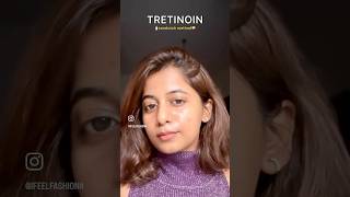 tretinoin sandwichmethod ashortaday skincare skincareroutine ashortaday ifeelfashionn [upl. by Pinelli]