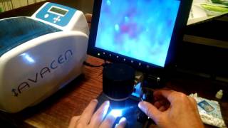 Avacen 100 Capillary Microscope Client Test 2 Pt 2 Results [upl. by Ettenel]