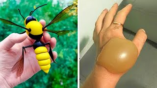 20 Most Painful Insect Bites In The World [upl. by Ilse]