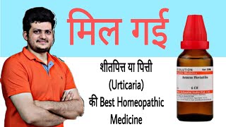 1 Best Homeopathic Medicine for Urticaria  हमेशा के लिए शीतपित्त या पित्ती का अंत सिर्फ एक दवा से [upl. by Minni]