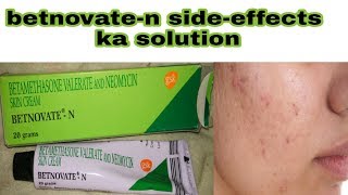 betnovate n cream ke sideeffects ka solution  how to use betnovate n cream  hindi [upl. by Odella]