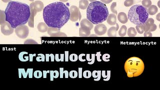 The different morphologies of Granulocytes neutrophils eosinophils and basophils [upl. by Trauts]