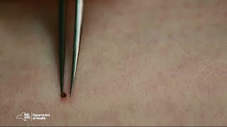 Proper Tick Removal [upl. by Aneelas]