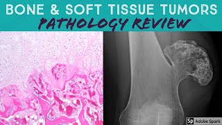 Bone amp Soft Tissue Pathology Board Review 21 Classic Cases [upl. by Bently]