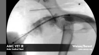 AMC IR Male Urethral Stent cw [upl. by Deane]