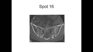 RADIOLOGY EXAM CASES [upl. by Ayekel]