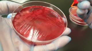 Microbiology Clostridium perfringens biochemical testing and colonial growth [upl. by Brightman]