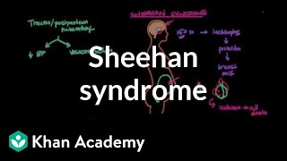 Sheehan syndrome  Reproductive system physiology  NCLEXRN  Khan Academy [upl. by Oralie]