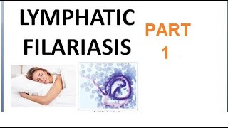 Parasitology 221 a Wuchereria Bancrofti Filariasis Filarial worm Elephantiasis Culex Microfilaria [upl. by Ramar]