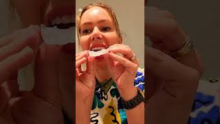 opalescence 16 carbamide peroxide professional home teeth whitening how to use guide by a dentist [upl. by Hayyim30]