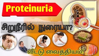 அப்பெண்டிக்ஸ் அறிகுறிகள் பற்றி தெரியுமா  Appendix symptoms in tamil Doctor Advice [upl. by Spiegel]