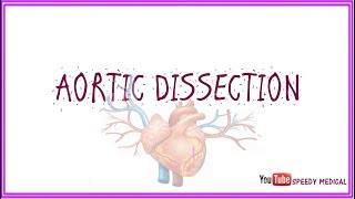 Aortic Dissection [upl. by Rudolf]