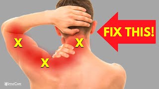 How to Instantly Relieve Nerve Pain in Your Neck and Arm [upl. by Ardnot]