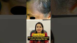 An important fact about Hair Dye skincare glowingskin skincaretips [upl. by Panayiotis]