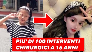 Questa Ragazza di 16 Anni ha Subito più di 100 interventi di chirurgia estetica [upl. by Elliven]