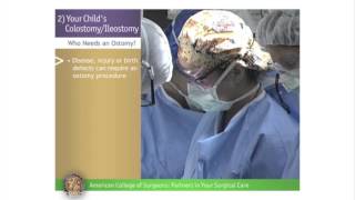 Pediatric ColostomyIleostomy Your Childs ColostomyIleostomy [upl. by Nerra]