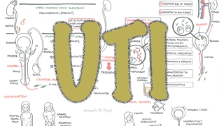 Urinary Tract Infection  Overview signs and symptoms pathophysiology causes and treatment [upl. by Eirallam15]