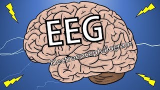 EEG టెస్ట్ అంటే ఏమిటి  What is Electro Encephalogram Test   Health Tips [upl. by Sorac]