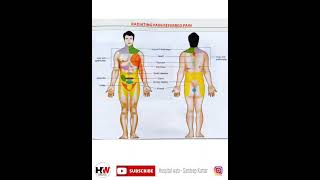 Radiating Pain  Referred pain [upl. by Farrish]