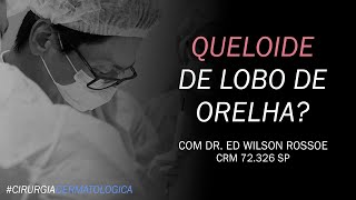 QUELOIDE DE LOBO DE ORELHA  DR ED WILSON ROSSOE  CIRURGIA DERMATOLÓGICA [upl. by Goetz523]