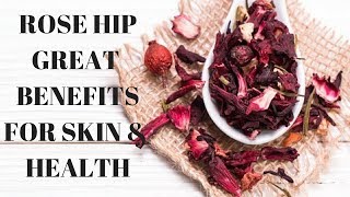 Incredible Skin amp Health Benefits of Rosehip Tea [upl. by Adnuhsal]