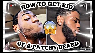 HOW TO FIX A PATCHY BEARD  PATCHY BEARD SOLUTION [upl. by Aerdnael]