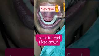 fpddentist dentistry [upl. by Buffy]