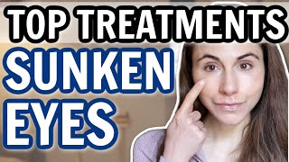 TOP TREATMENTS FOR SUNKEN EYES amp HOLLOWS 👀 Dermatologist DrDrayzday [upl. by Eniahpets]