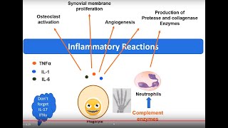 Rheumatoid Arthritis pathology in 5 minutes [upl. by Jermaine]