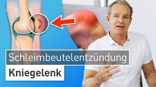 Knie angeschwollen und gerötet Das hilft bei Schleimbeutelentzündung am Knie  Dr Stefan Preis [upl. by Yllatan]