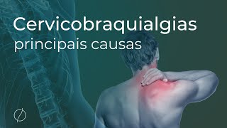 Principais causas das Cervicobraquialgias  dor que irradia do pescoço para o braço [upl. by Richy]