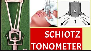 Schiotz Tonometry parts principle procedure and disadvantages [upl. by Nirol]