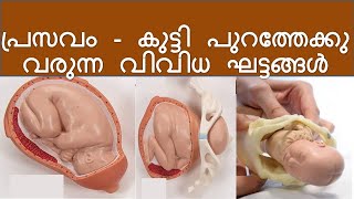 Stages of Delivery Malayalam  Normal Delivery step by step [upl. by Andrej414]