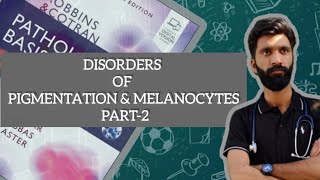 DISORDERS OF PIGMENTATION AND MELANOCYTES PART2 PATHOLOGY ROBBINS BASIS [upl. by Brownson54]