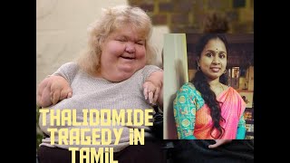 THALIDOMIDE TRAGEDY in tamilimportance of stereochemistry [upl. by Gombach]