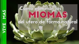 como eliminar los miomas del utero de forma natural [upl. by Clarkson211]