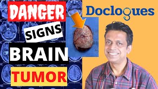 Danger Signs of a Brain Tumor [upl. by Introc]