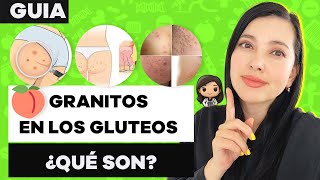 ¿Tienes GRANITOS en los GLÚTEOS TE CUENTO SOBRE FOLICULITIS [upl. by Marcello]