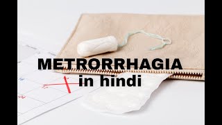 Metrorrhagia in Hindi obsgyne abnormal uterine bleeding mbbsstudy obsgyne [upl. by Meras960]